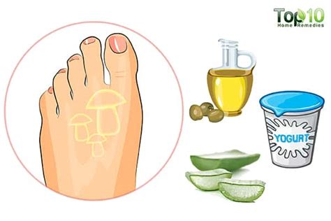 Home Remedies for Itchy Feet | Top 10 Home Remedies