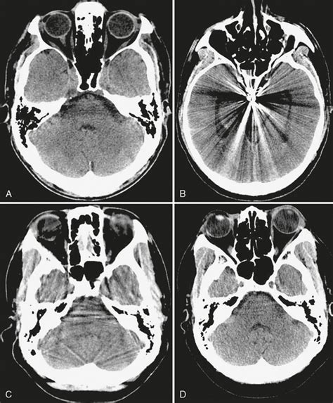 Static Anatomic Techniques | Radiology Key