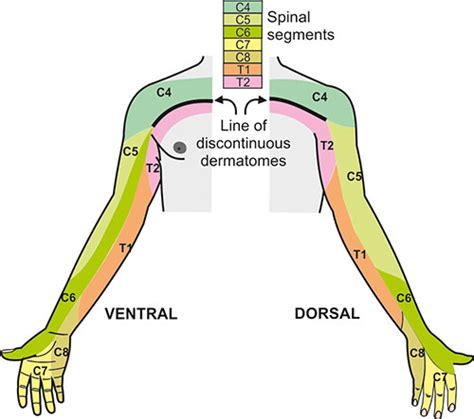 Dermatome Upper Limb