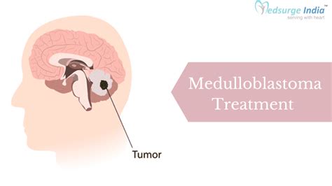 Medulloblastoma Treatment In India | Medulloblastoma Treatment Cost