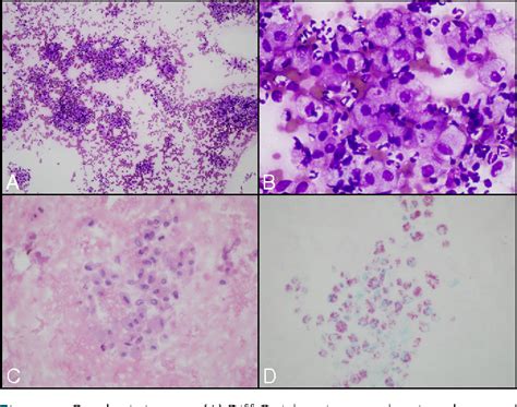 Mycobacterium Avium