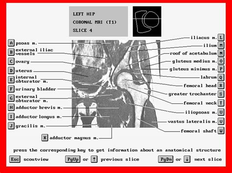 MRI HIP JIONT ANATOMY Dr/AHMED EISAWY - YouTube