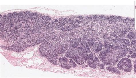 Histology Images: Immune System Flashcards | Quizlet