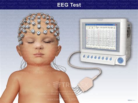 Electroencephalogram (EEG) Test - Trial Exhibits Inc.