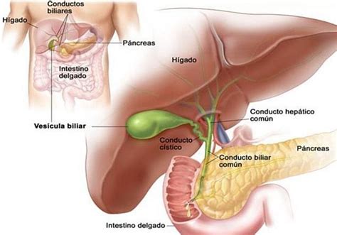 Mi vida y mi dieta después de operarme de cálculos en la vesícula