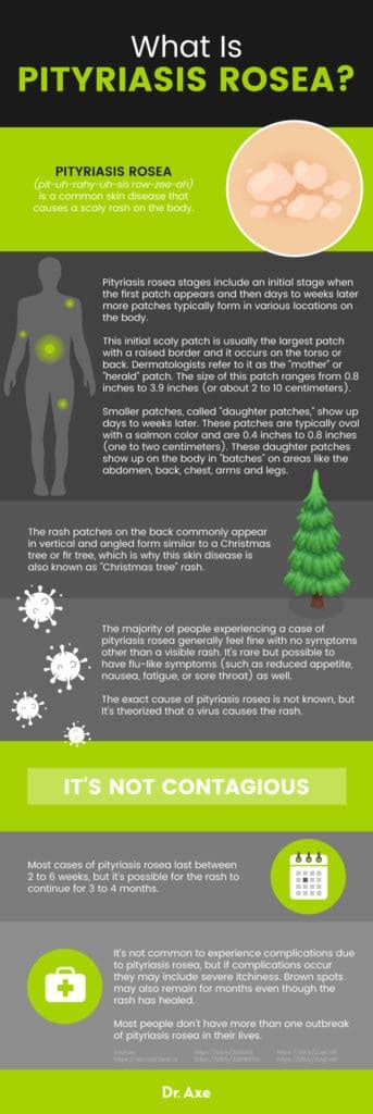 Pityriasis Rosea: 6 Natural Ways to Help Treat 'Christmas Tree' Rash