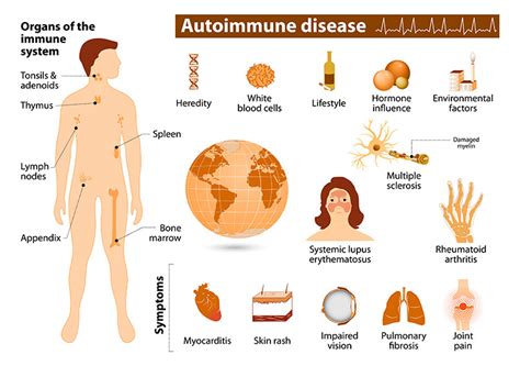 National Institute of Environmental Health Sciences: Autoimmune Diseases