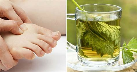 10 Natural Remedies That Can Help Alleviate Your Gout Symptoms