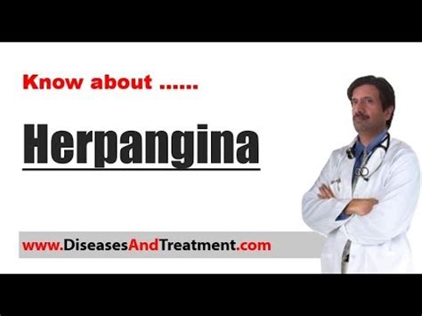 Herpangina : Causes, Diagnosis, Symptoms, Treatment - YouTube