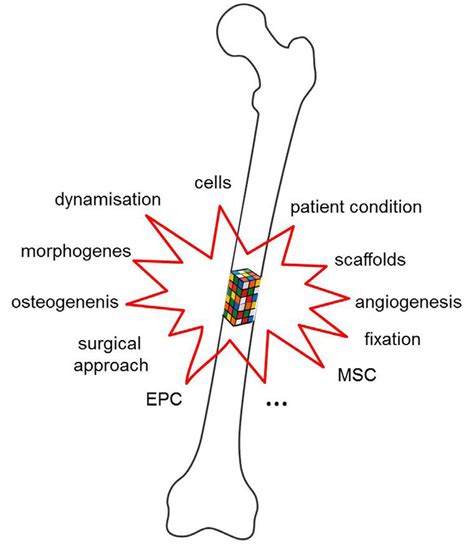 Large bone defect: a multifaceted challenge. Bone healing is a complex... | Download Scientific ...