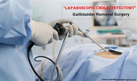 Gallbladder Removal Surgery Cost | Gallstone Treatment Texas | Recovery