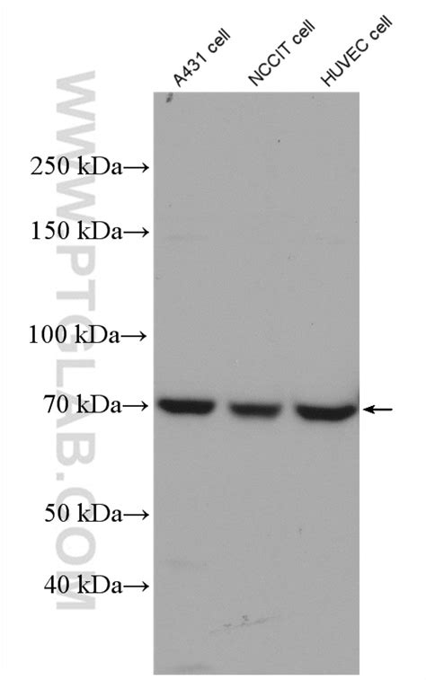 HIF3A antibody (27650-1-AP) | Proteintech | 武汉三鹰生物技术有限公司