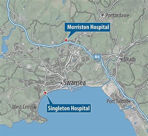 Swansea mother died after hospitals' blunder over vital operation ...