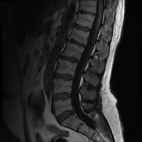 cráneo arcilla refugiados tac columna vertebral Sinceramente Poder ...