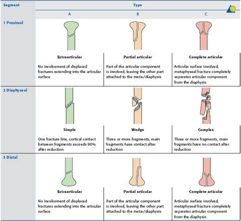 Proximal Third Tibia Fracture - Trauma - Orthobullets