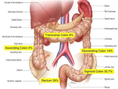 Ascending Colon – Definition, Location, Function, Problems, Cancer and Images - Body Terms