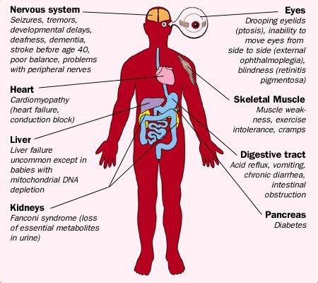 Symptoms of Mitochondrial Disease