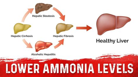 How to Lower Your Ammonia From Liver Cirrhosis and Other Conditions | Cirrhosis, Healthy liver ...