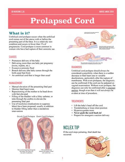 Knee Chest Position For Prolapsed Cord