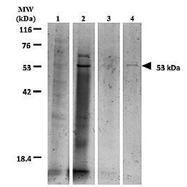 Tricine SDS gel electrophoresis for molecular weight determination of ...