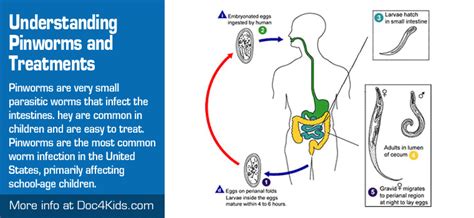 Understanding Pinworms and Treatments - Doc4Kids.com