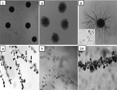 Light microscopy images of Chlamydospore (with hyphae) formation of C.... | Download Scientific ...