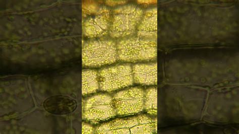 Normal Cell -- Elodea (Anacharis) showing cytoplasmic streaming and ...