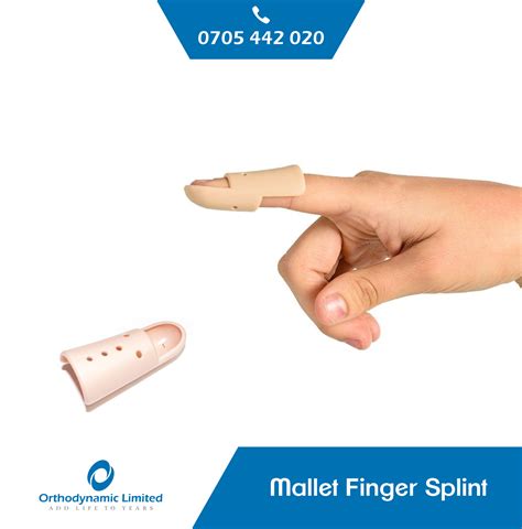 Mallet Finger Splints - available - cheap - Orthodynamic Limited