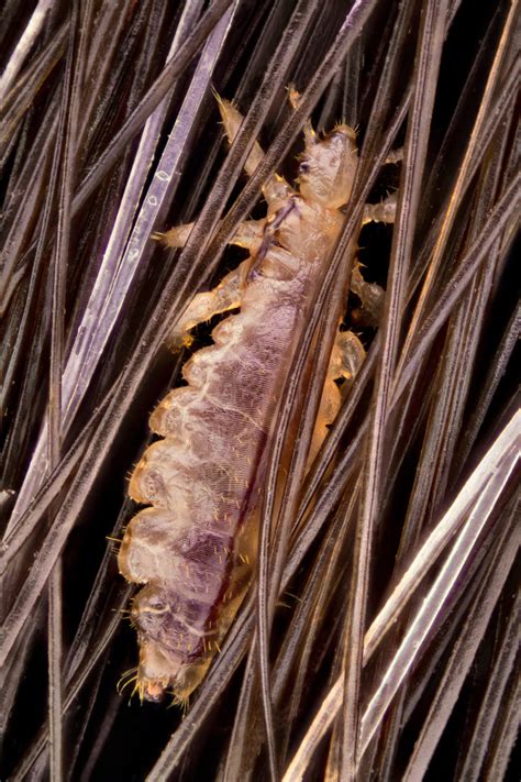 Head louse (Pediculus humanus capitis) | Nikon’s Small World