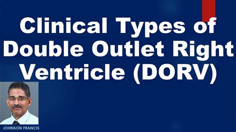 Clinical Types of Double Outlet Right Ventricle (DORV) - YouTube