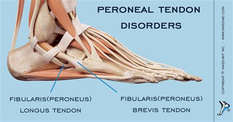 What Are Peroneal Tendon Disorders? - MASS4D® Foot Orthotics