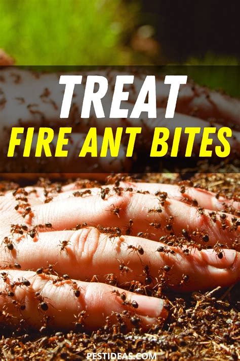 Treat Fire Ant Bites- No More Itch