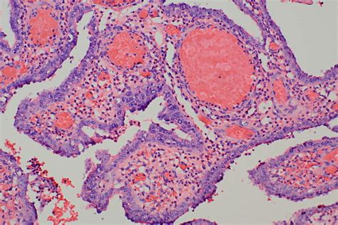 Diapedesis Histology