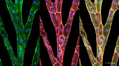 Image Analysis Technique Provides Better Understanding of Heart Cell Defects - AIP Publishing LLC