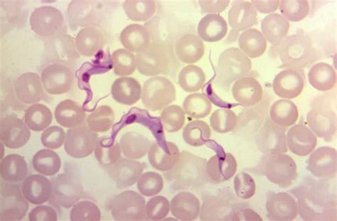 Trypanosoma cruzi/Chagas disease | Concise Medical Knowledge