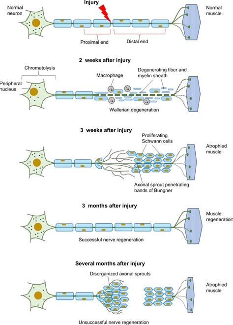 Cellular responses to nerve injury: nerve degeneration and regeneration. | Download Scientific ...