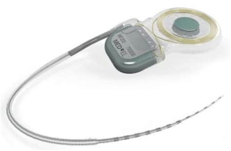 FDA Approves Cochlear Implant for MRI with Internal Magnet in Place