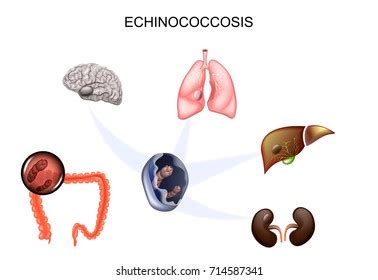 102 Liver decease Images, Stock Photos & Vectors | Shutterstock