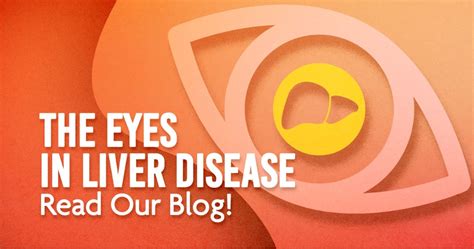 The Effects of Liver Health on Eyesight - Arizona Liver Health