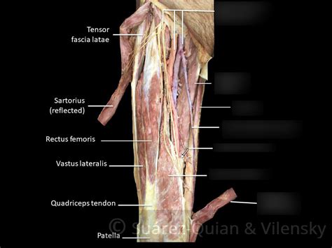 Cadaver Leg Muscles Labeled