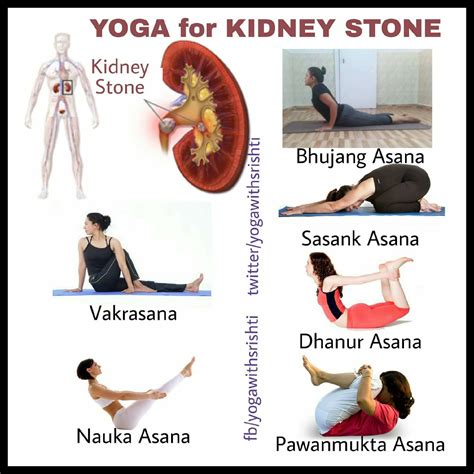 exercise for kidney stone - Caption Simple