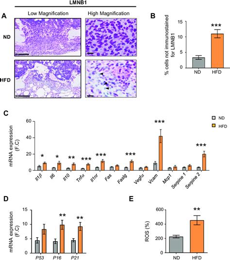 Bone marrow microenvironment and bone marrow osteoprogenitor cells ...