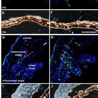 Localization of the macrophage marker F4/80 to clump cells in type 5 ...