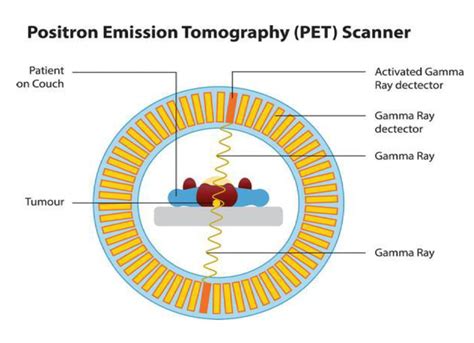 POSITRON EMISSION TOMOGRAPHY - Focus Dentistry