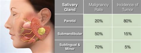 Parotid Tumor Treatment Los Angeles | Dr. Larian