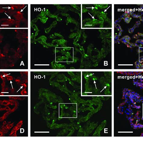 | Representative pictures showing biliverdin reductase immunostaining ...