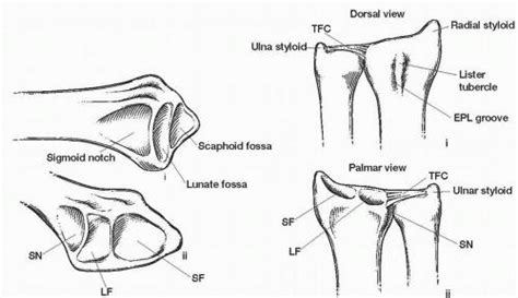 Radial Styloid Fracture Splint