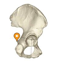 Ischial spine - e-Anatomy - IMAIOS