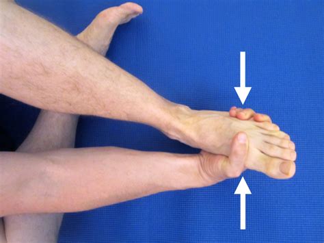 Do I have Morton's Neuroma in my Foot? | The Physical Therapy Advisor