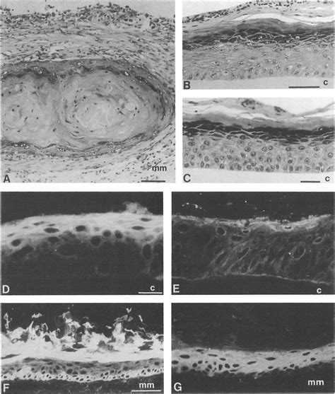 Histological sections of 2-wk-old HaCaT transplants. (.4) Suspensions ...